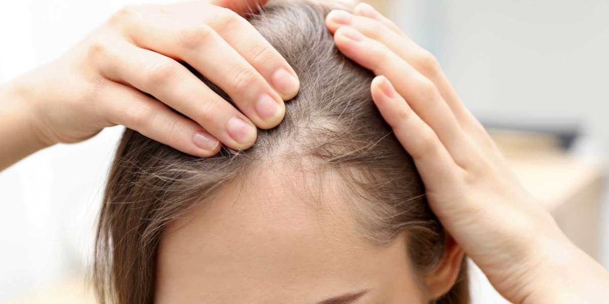Benefits of Hair Treatment at Palm Desert Clinic