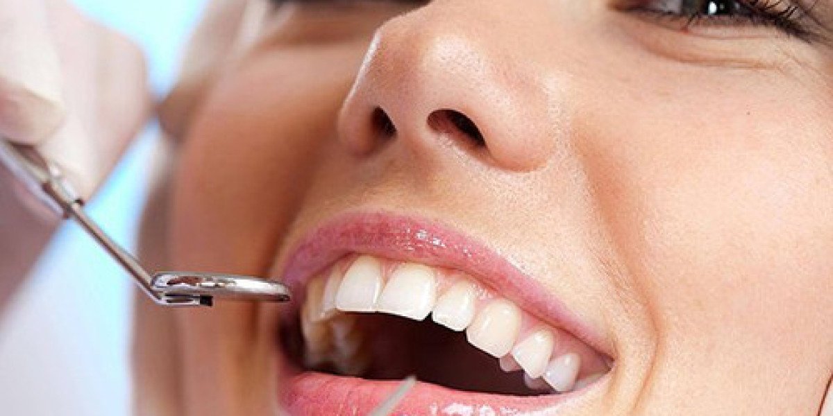 The Comprehensive Guide to Dental Implants in Tampa