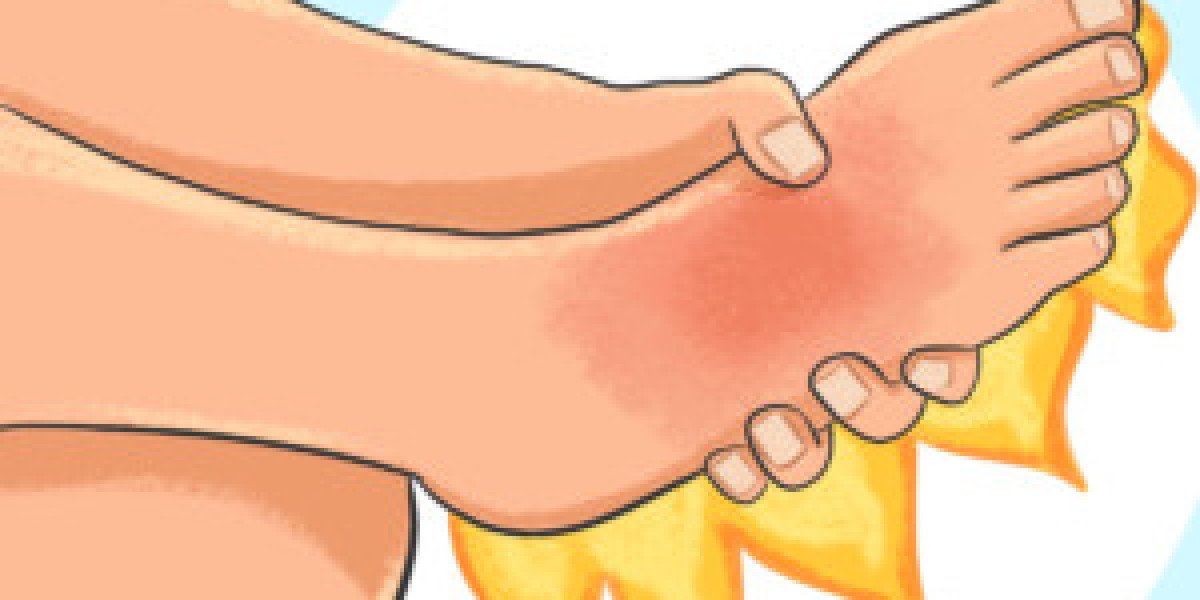 What Causes of Burning in the Feet?