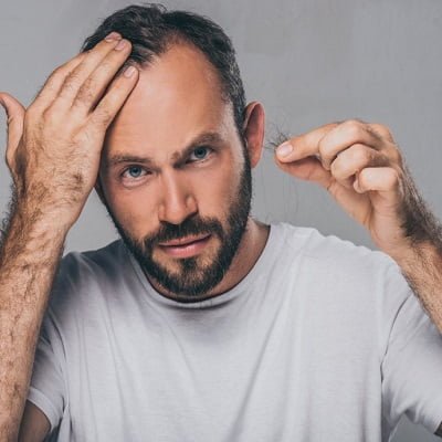 Hair Loss Treatment In Islamabad Pakistan - RCS