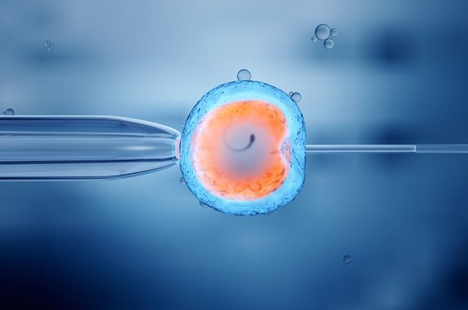 What is IVF Treatment?