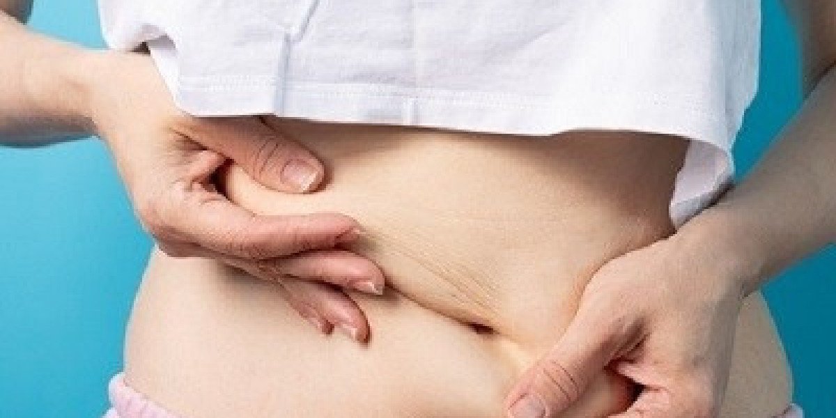 Is Liposuction Safe for Patients in Islamabad?