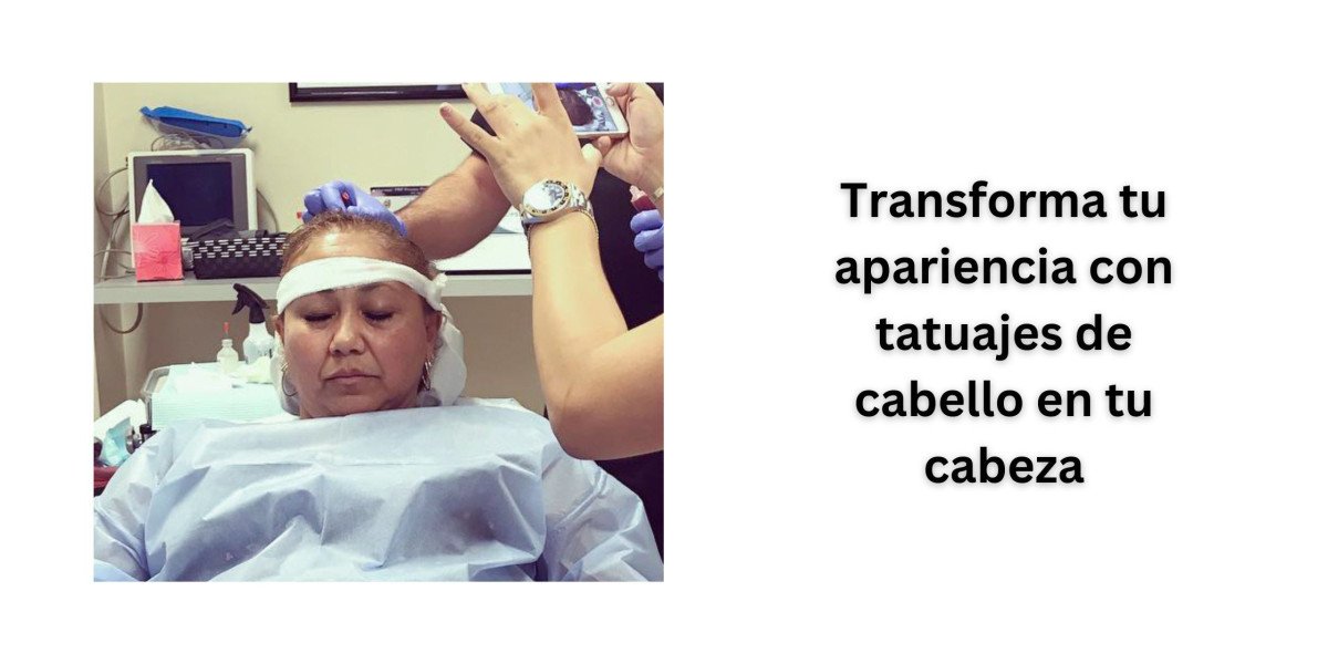 Transforme su apariencia con implantes capilares para mujeres