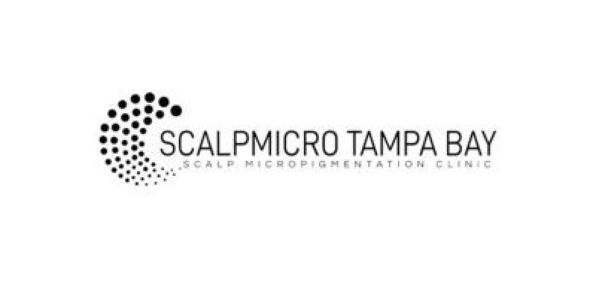 Best Scalp Micropigmentation in Chicago: Scalp Micro Tampa Bay-Chicago