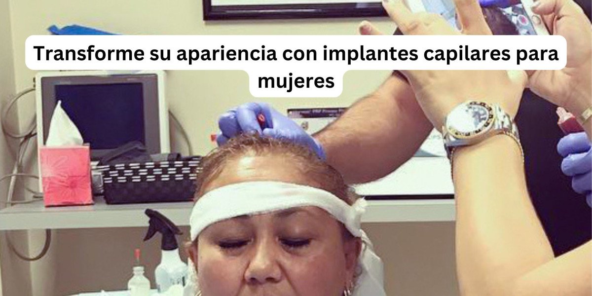 Transforme su apariencia con implantes capilares para mujeres