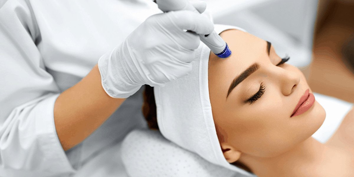 Best HydraFacial in Edmonton: A Comprehensive Guide by Vitaluxe