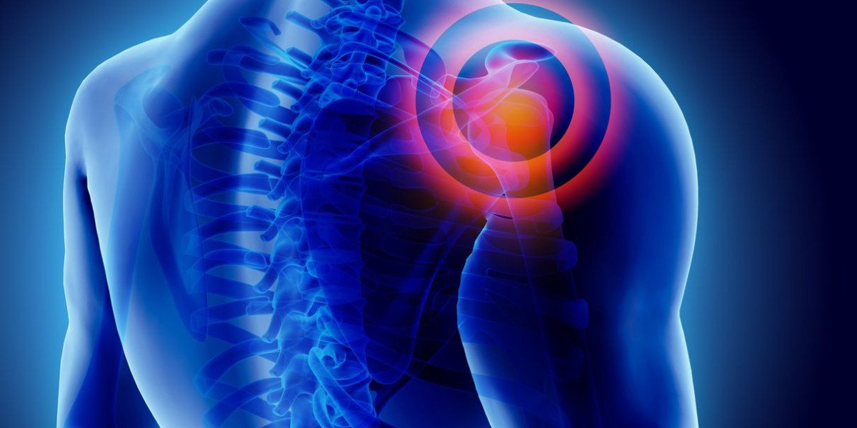 High-Altitude Pain Management with Tapentadol 200 mg