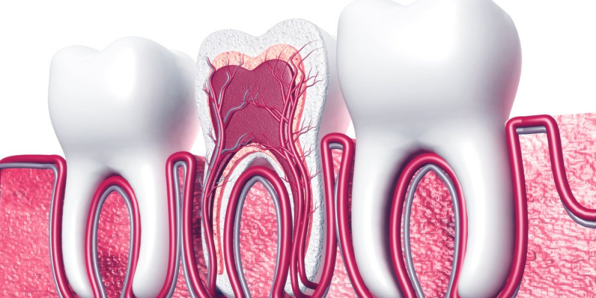 FAQs About Root Canal Treatment in Islamabad